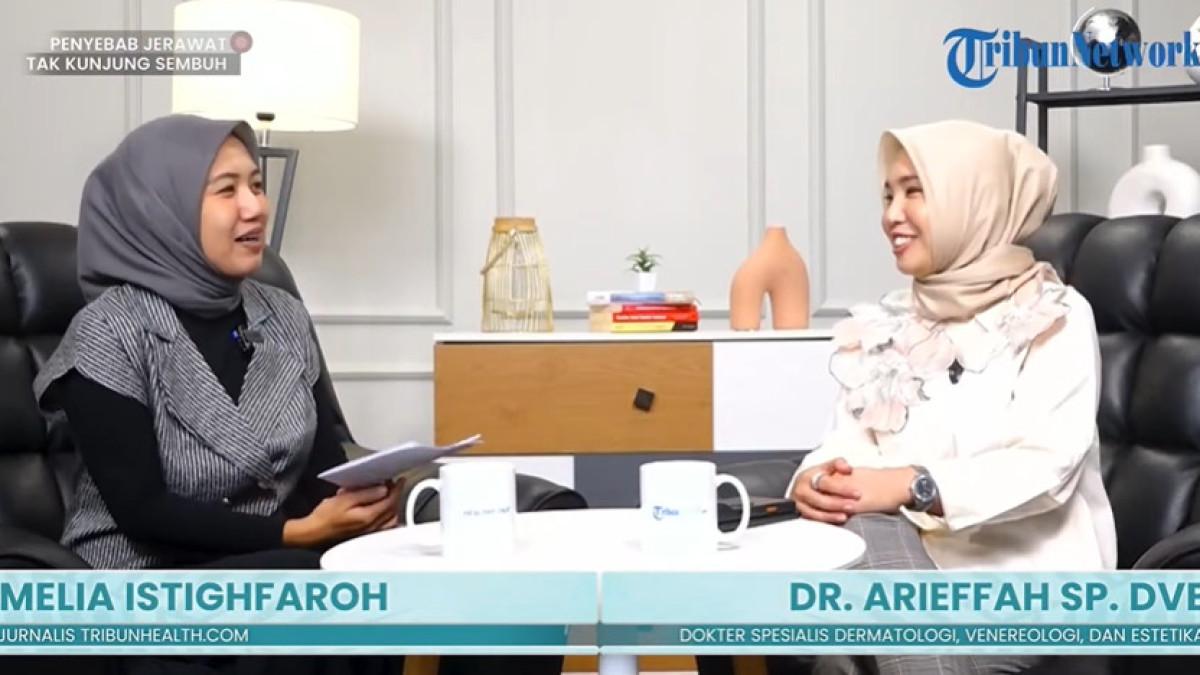 Jerawat Bukan Sekadar Masalah Kosmetik, Ini Penjelasan Dokter