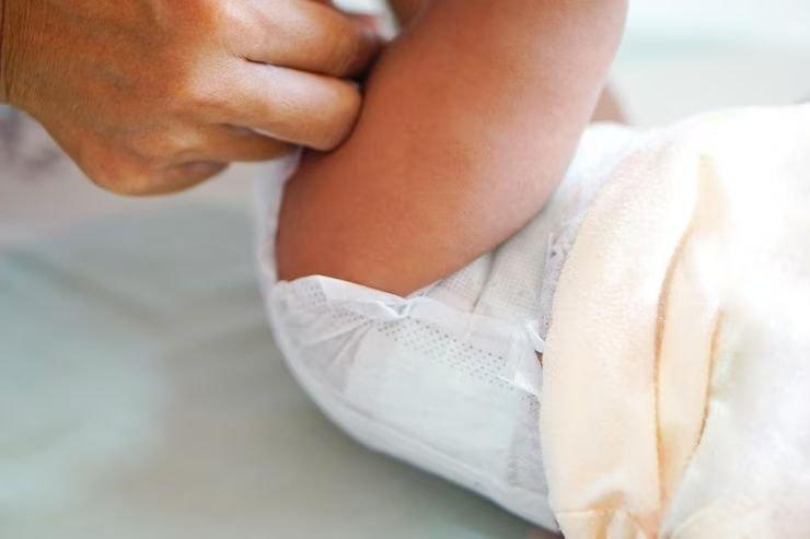 Rekomendasi 5 Baby Rash Cream untuk Melindungi Kulit Bayi dari Ruam ...